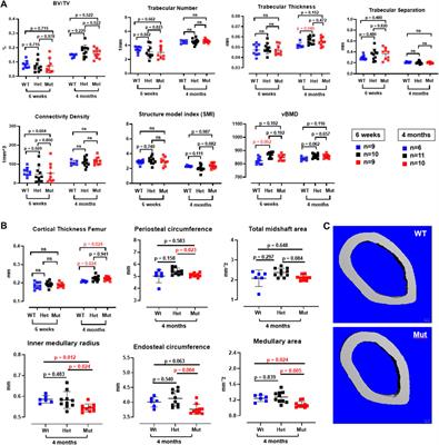 A Rab33b missense mouse model for Smith-McCort dysplasia shows bone resorption defects and altered protein glycosylation